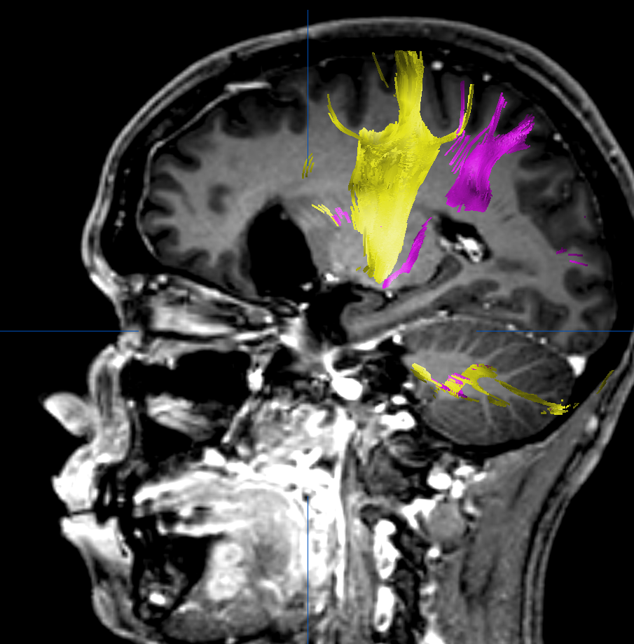 Computational Imaging .png, 17 kB