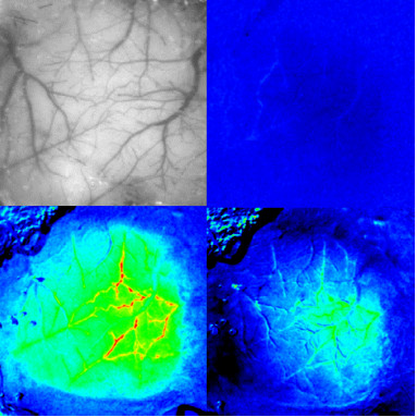 Cellular underpinnings of neurovascular coupling in health and disease .png, 17 kB